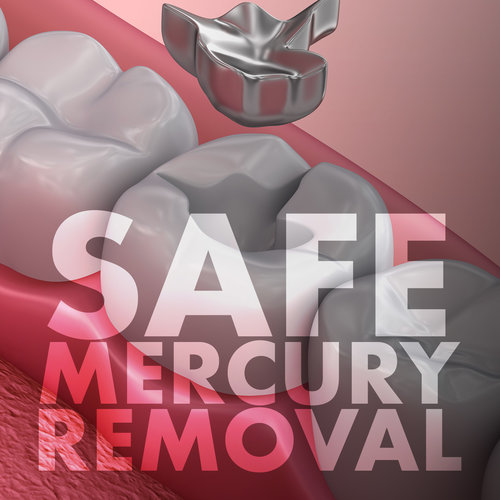 Graphic showing safe mercury removal